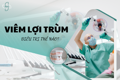 Viêm lợi trùm điều trị thế nào?